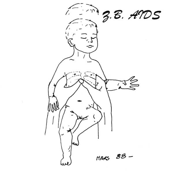 Z.B. AIDS – Gestalt
